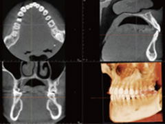3D･CT撮影装置を導入済み！